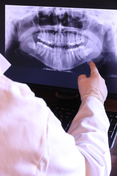 Best Emergency Dentist for Lost Fillings or Crowns in Mount Gilead, OH