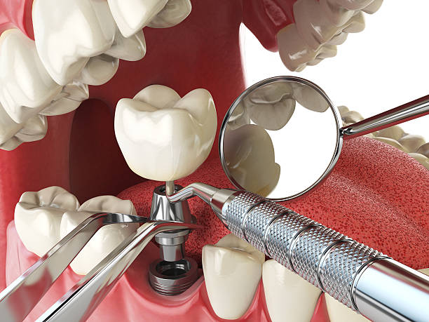 Best Emergency Cosmetic Dentistry in Mount Gilead, OH